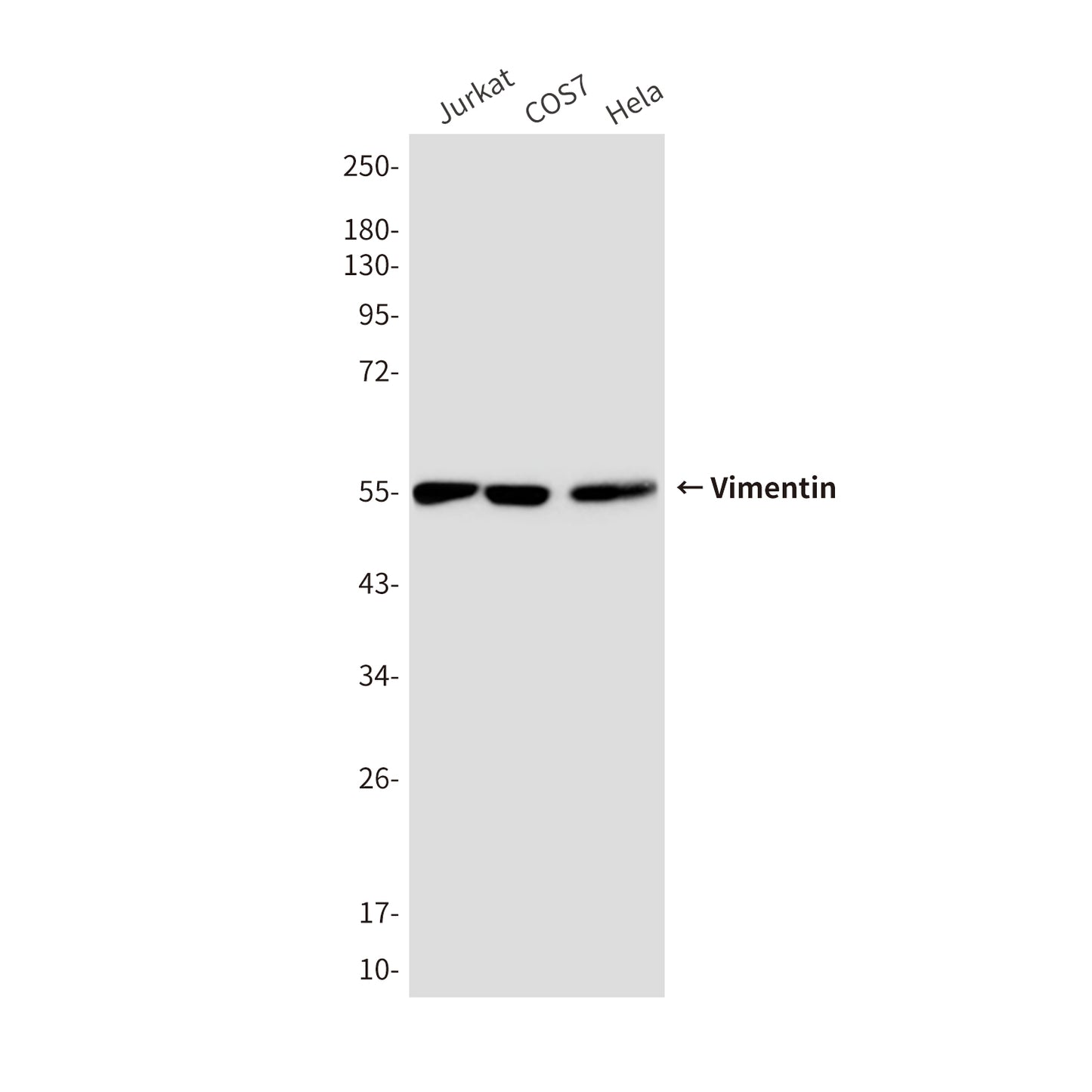 Vimentin (10E2) Mouse Monoclonal Antibody