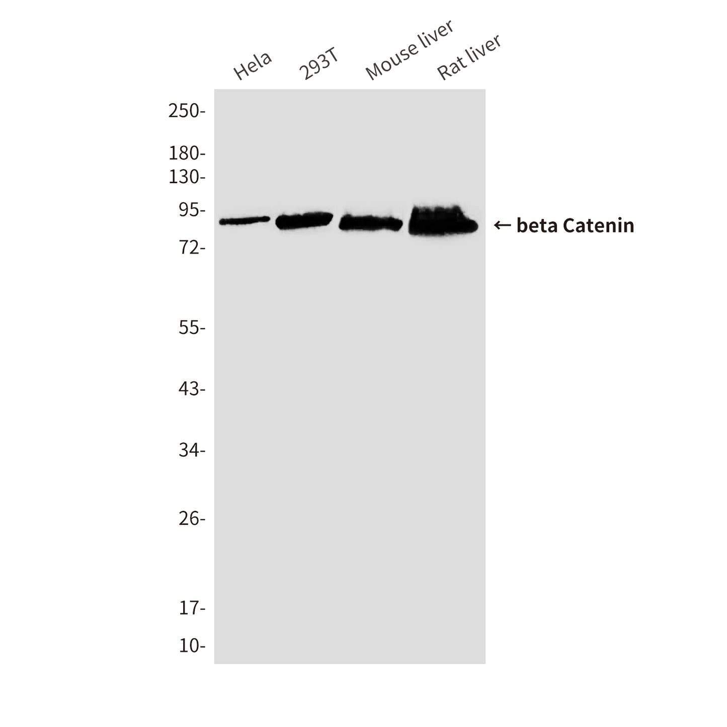 beta Catenin (7E2) Mouse Monoclonal Antibody