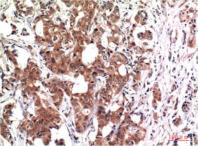 GSK3 beta (9B1) Mouse Monoclonal Antibody
