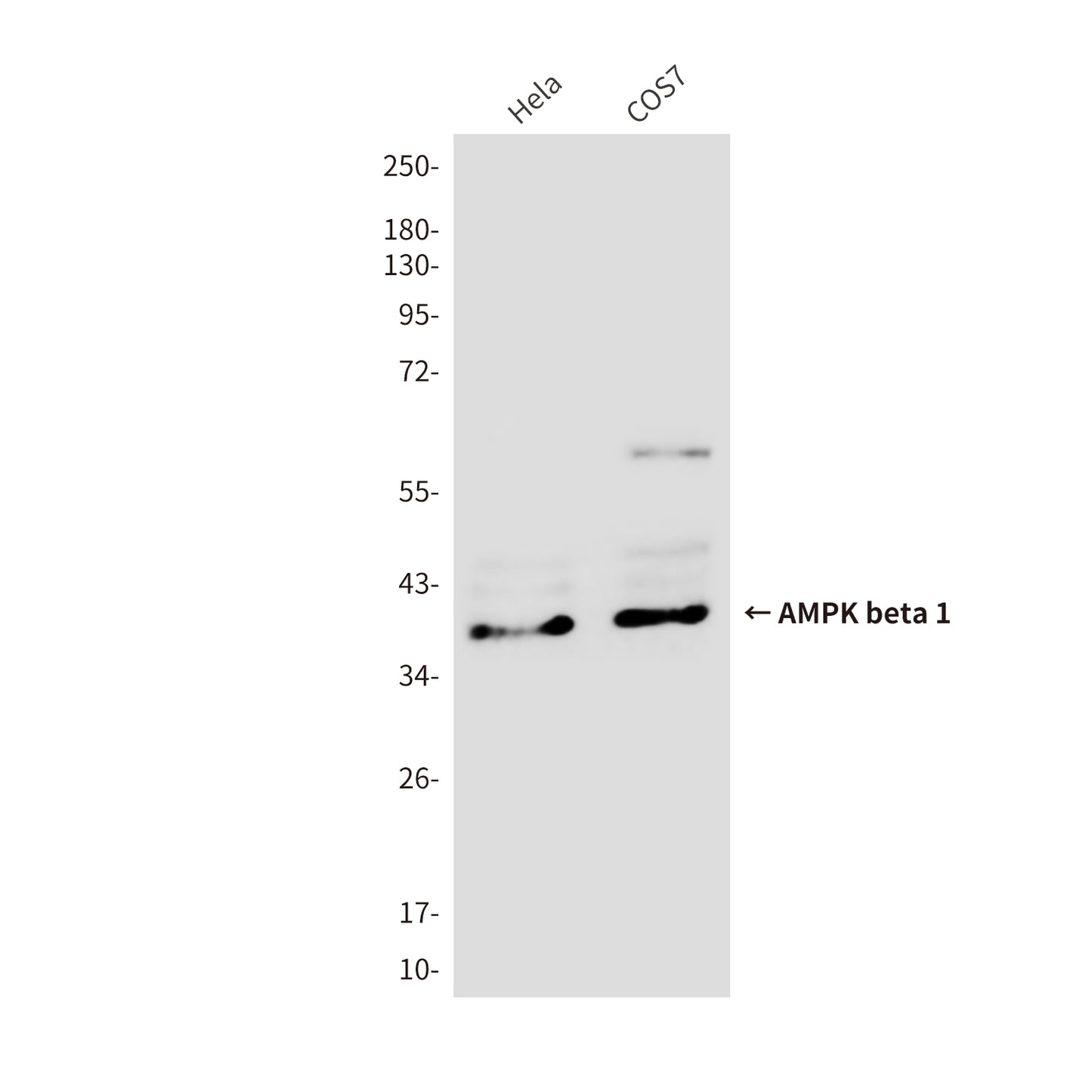 AMPK beta 1 Mouse Monoclonal Antibody