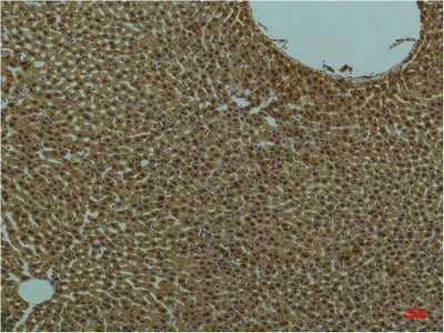 PI3 Kinase p85 alpha (3H5) Mouse Monoclonal Antibody