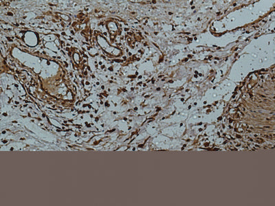 Galectin 3 (7G9) Mouse Monoclonal Antibody