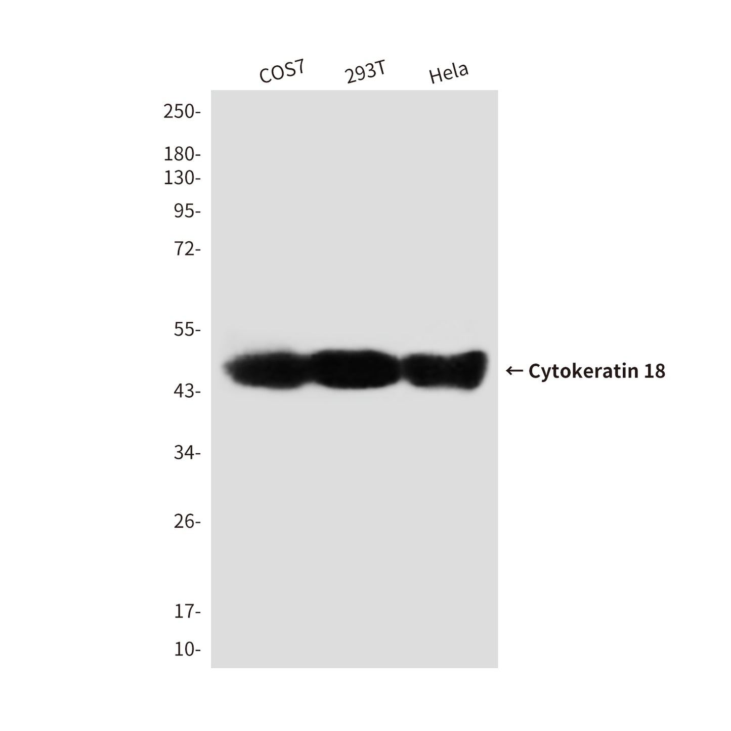 Cytokeratin 18 (2B5) Mouse Monoclonal Antibody