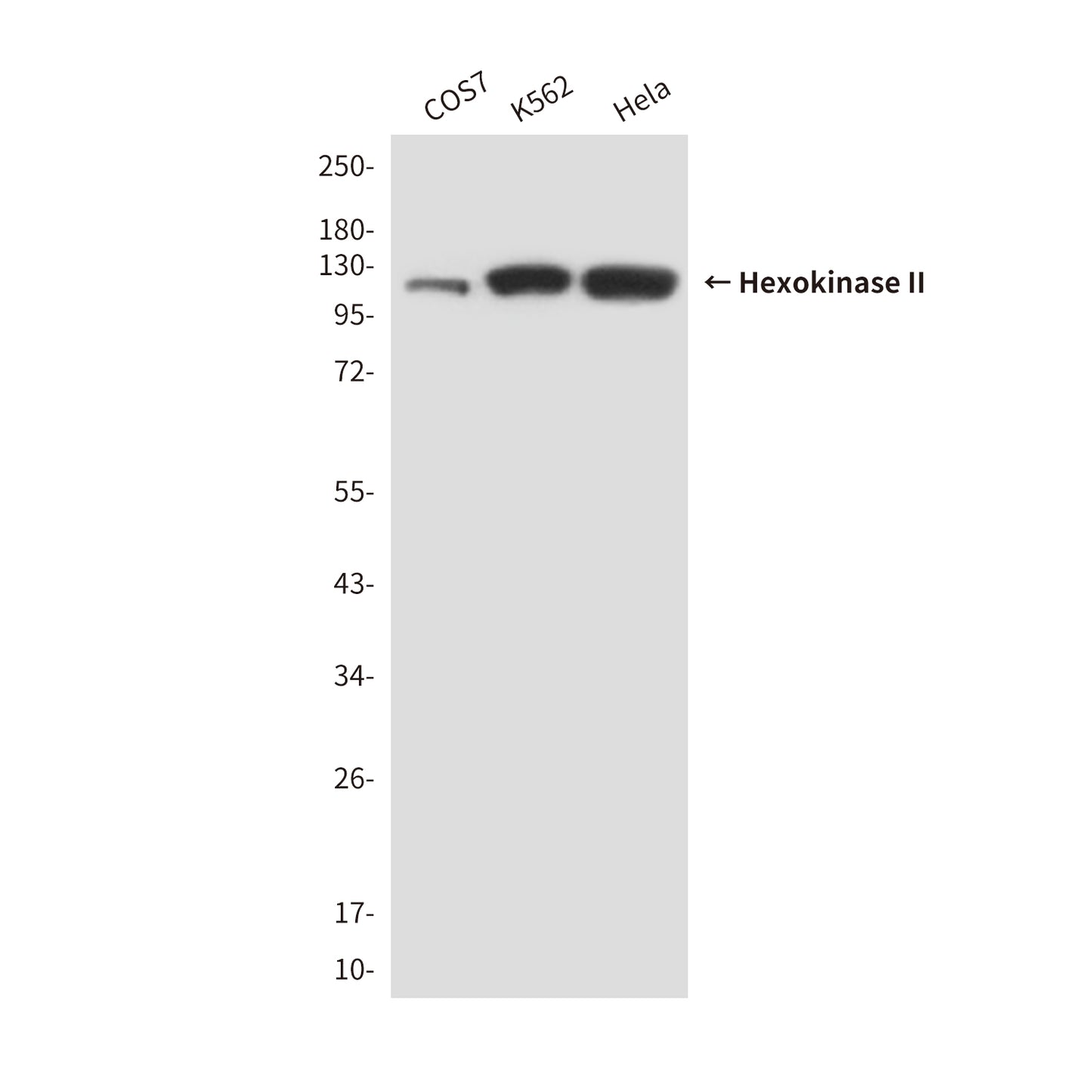 Hexokinase II (3B9) Mouse Monoclonal Antibody