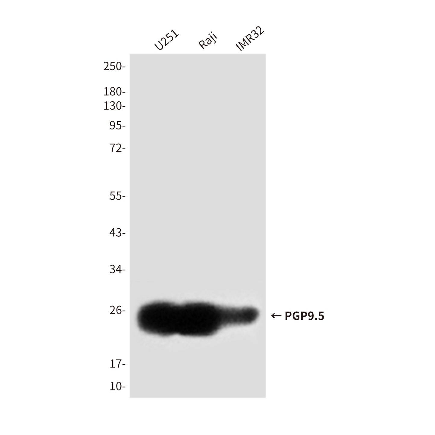 PGP9.5 (7B8G5E7) Mouse Monoclonal Antibody