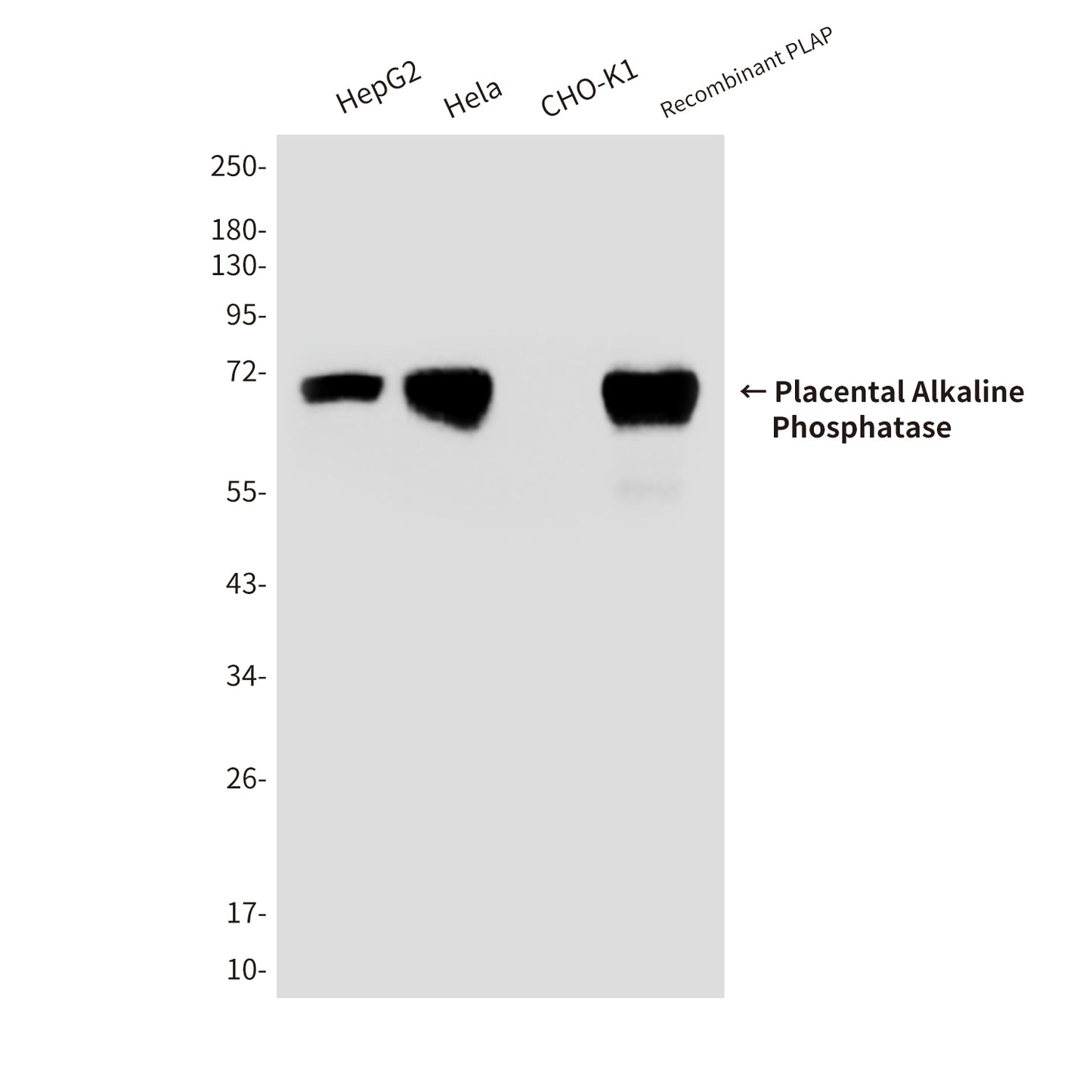 Placental Alkaline Phosphatase Mouse Monoclonal Antibody