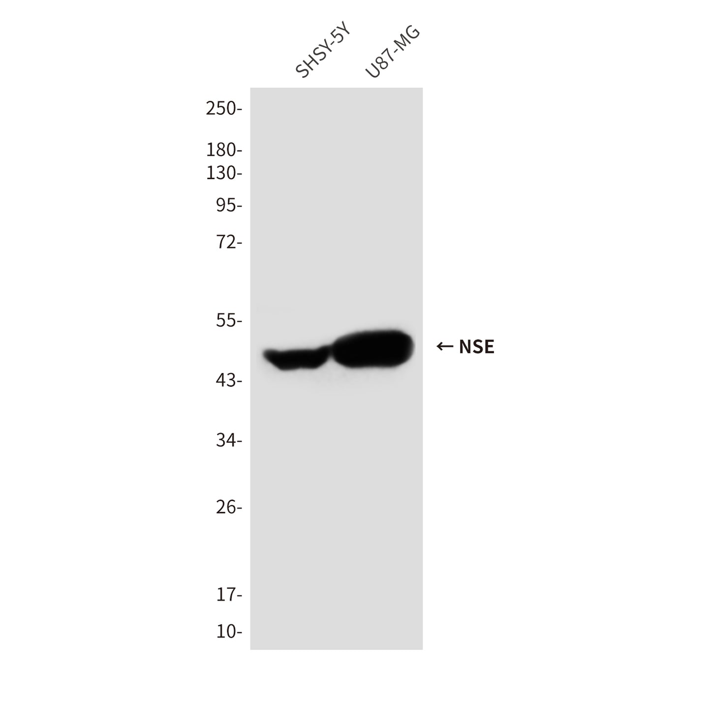 NSE (1G7) Mouse Monoclonal Antibody