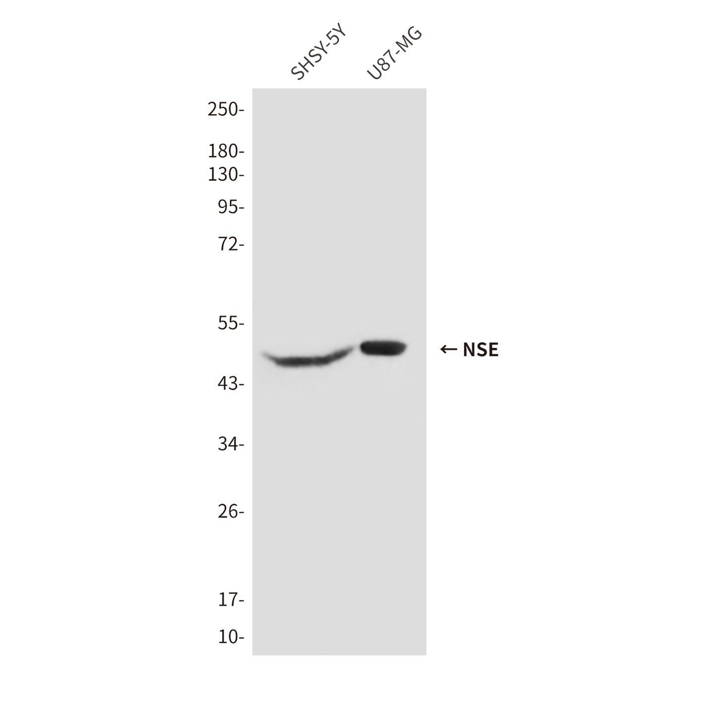 NSE (1H8) Mouse Monoclonal Antibody