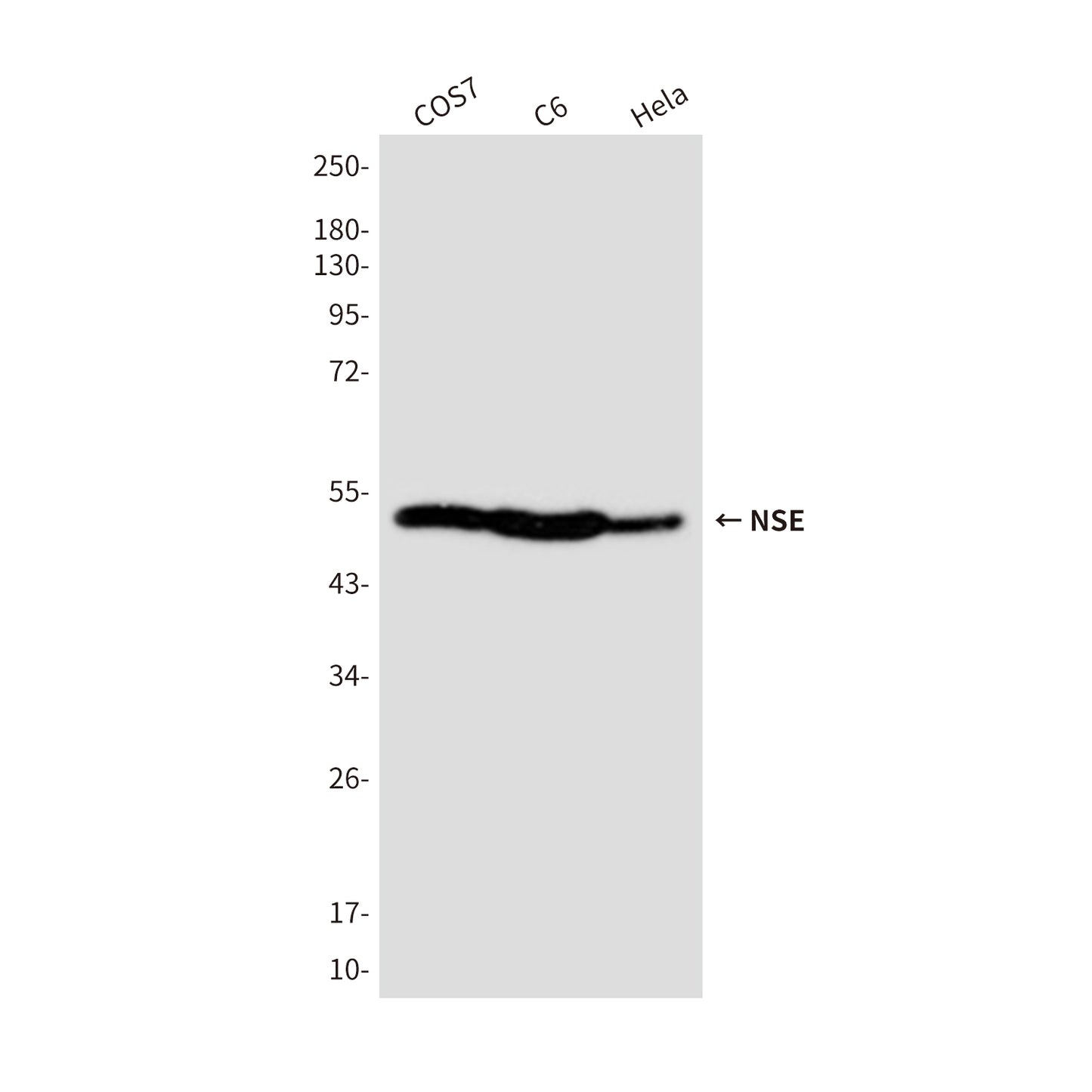NSE (4C7) Mouse Monoclonal Antibody