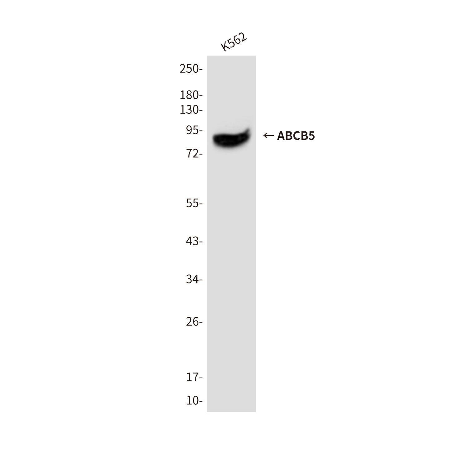 ABCB5 (8D2) Mouse Monoclonal Antibody
