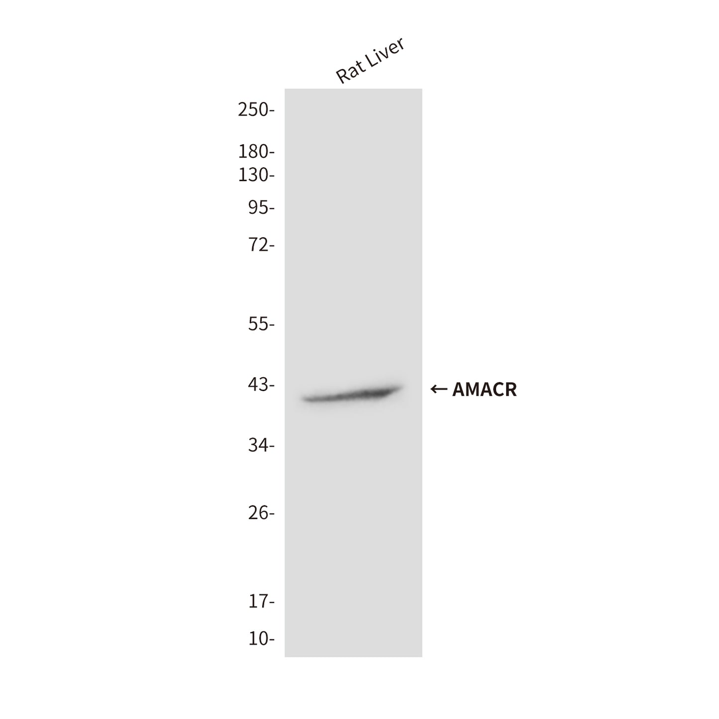 AMACR (2F3) Mouse Monoclonal Antibody