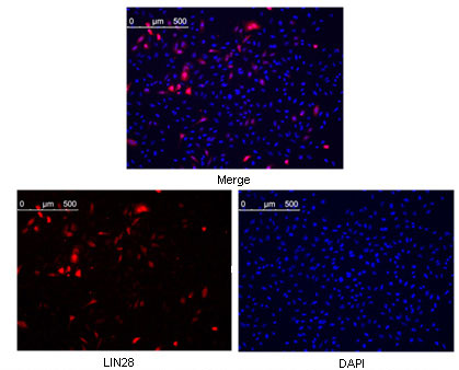 LIN28A (9G2) Mouse Monoclonal Antibody