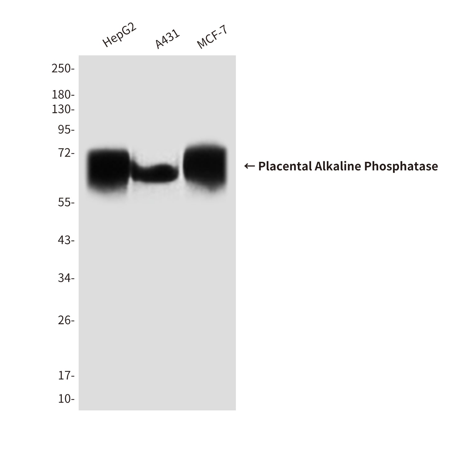 Placental Alkaline Phosphatase Mouse Monoclonal Antibody