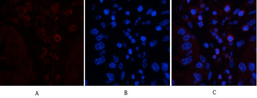 CD45 (8C1) Mouse Monoclonal Antibody