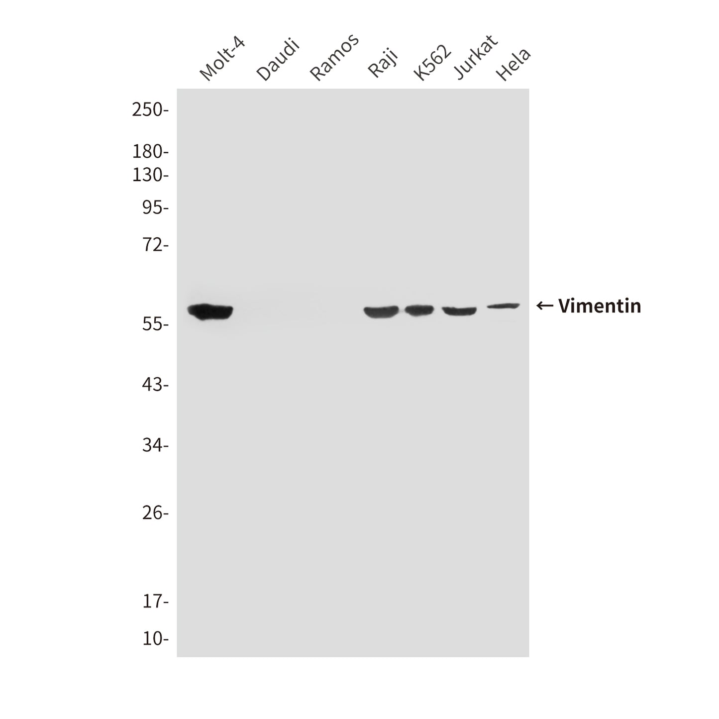 Vimentin (4F8) Mouse Monoclonal Antibody