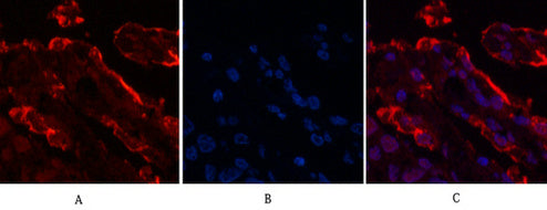 Galectin 3 (4B2) Mouse Monoclonal Antibody