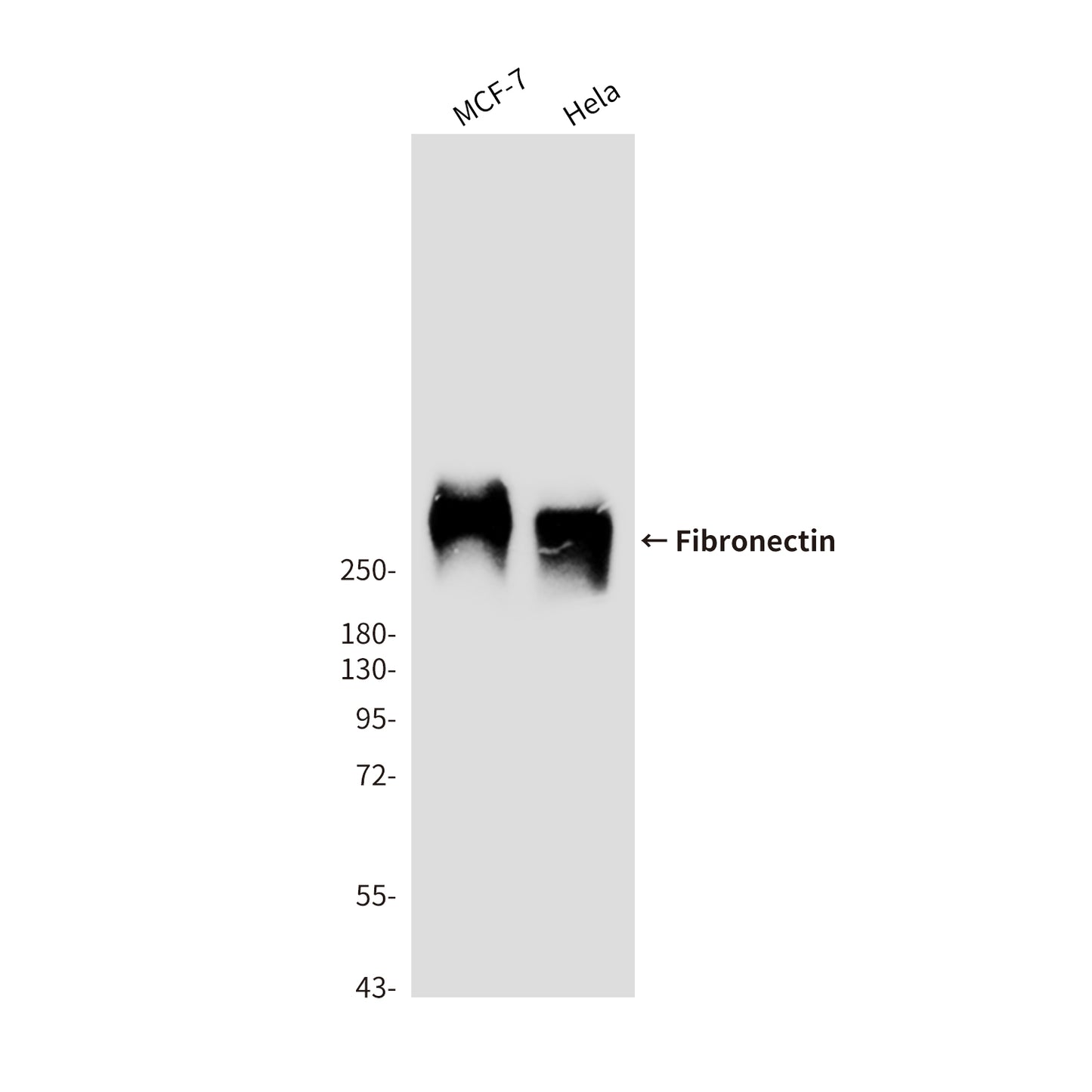 Fibronectin (1E2) Mouse Monoclonal Antibody