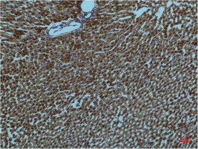 PI3 Kinase p85 alpha (1C8) Mouse Monoclonal Antibody
