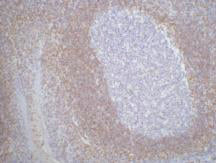Bcl2 (3H5) Mouse Monoclonal Antibody