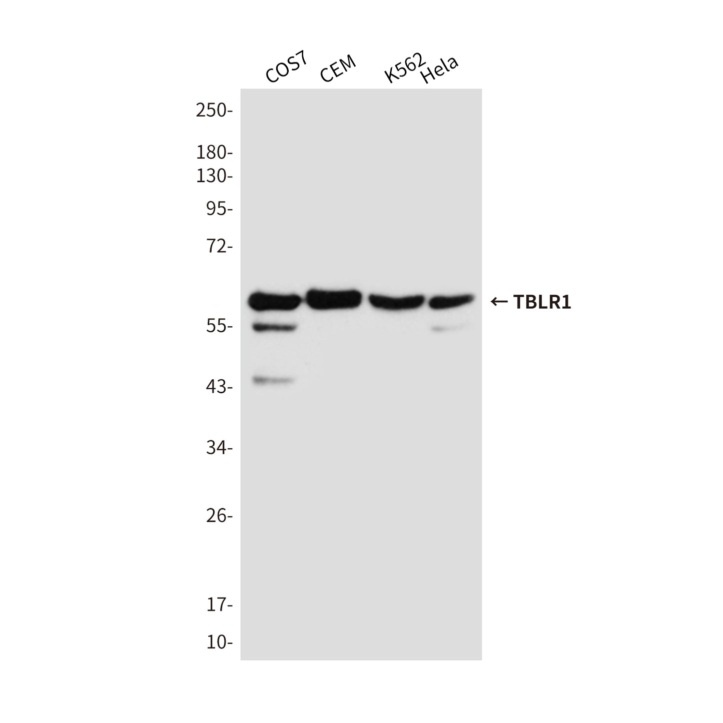 TBLR1 Mouse Monoclonal Antibody