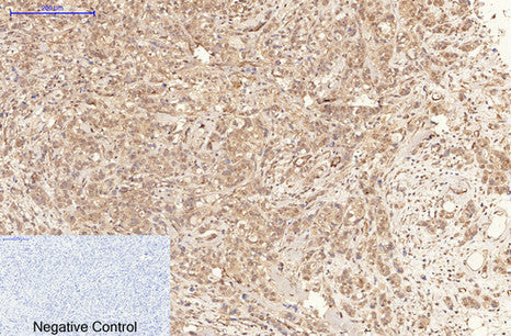 phospho-MLKL(S358)(6F8)Mouse Monoclonal Antibody
