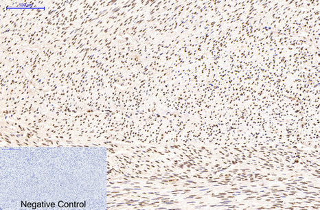 Histone H3(Tri Methyl Lys79)(3G3)Mouse Monoclonal Antibody