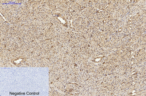 α-tubulin(Acetyl Lys40)(4A8)Mouse Monoclonal Antibody