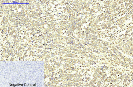 ABCB5(11A2)Mouse Monoclonal Antibody