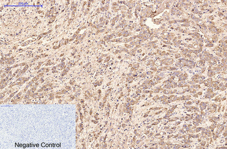 AFP alpha 1 Fetoprotein(17C5)Mouse Monoclonal Antibody