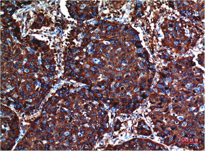 AKT(10D6)Mouse Monoclonal Antibody