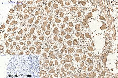 AMACR(4A12)Mouse Monoclonal Antibody