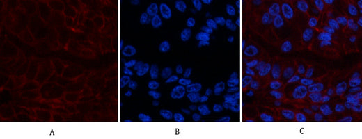CA IX(12F10)Mouse Monoclonal Antibody