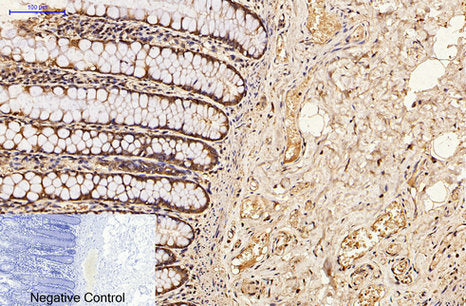 CDX2(14H6)Mouse Monoclonal Antibody