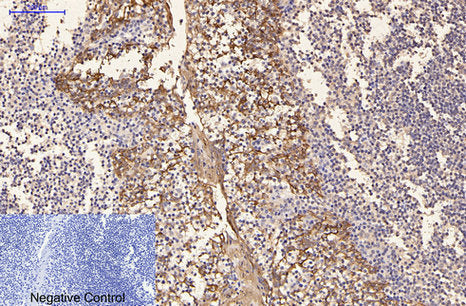 CK16(6F6)Mouse Monoclonal Antibody