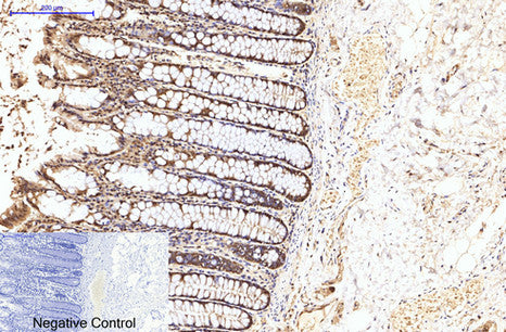 eIF4A1(M8)Mouse Monoclonal Antibody