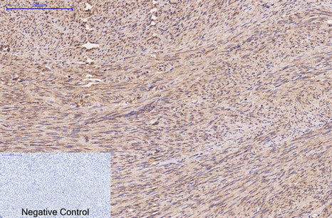 FH(7F1)Mouse Monoclonal Antibody