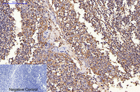 HER2(11H9)Mouse Monoclonal Antibody