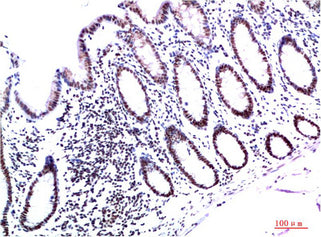 HP-1γ(3B9)Mouse Monoclonal Antibody
