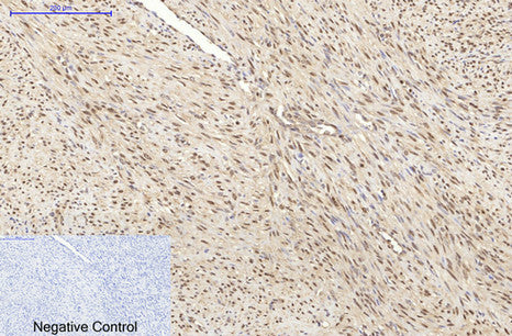 HSP70(3G10)Mouse Monoclonal Antibody