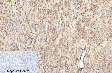 Ki 67(4A8)Mouse Monoclonal Antibody
