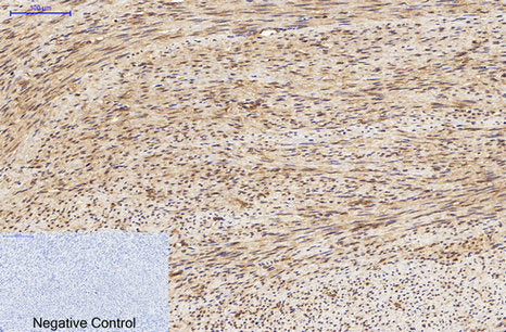 LC3A(5G10)Mouse Monoclonal Antibody