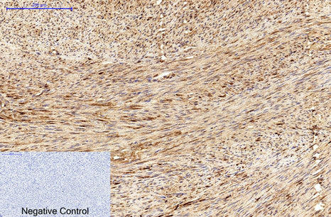 MICU1(Mix)Mouse Monoclonal Antibody