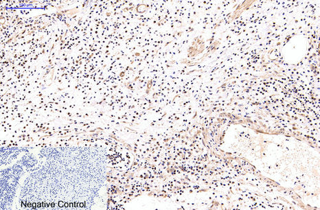 NFkB p65(5G6)Mouse Monoclonal Antibody