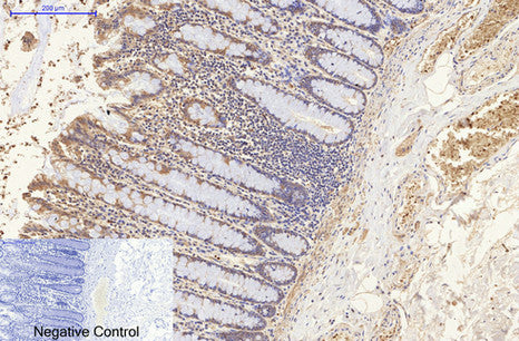 NSE(13E2)Mouse Monoclonal Antibody