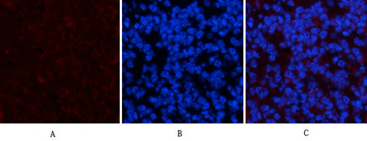 PDGFRα(7A3)Mouse Monoclonal Antibody
