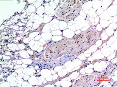 Smad3(4C9)Mouse Monoclonal Antibody