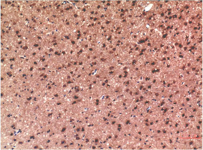 Tau(10E3)Mouse Monoclonal Antibody