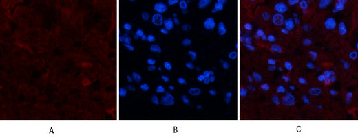 TTR(1D7)Mouse Monoclonal Antibody
