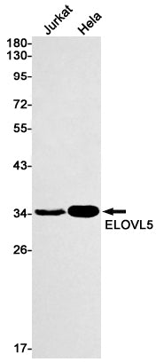 ELOVL5 Rabbit Monoclonal Antibody
