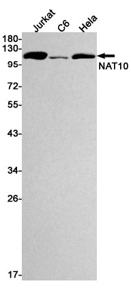 NAT10 Rabbit Monoclonal Antibody